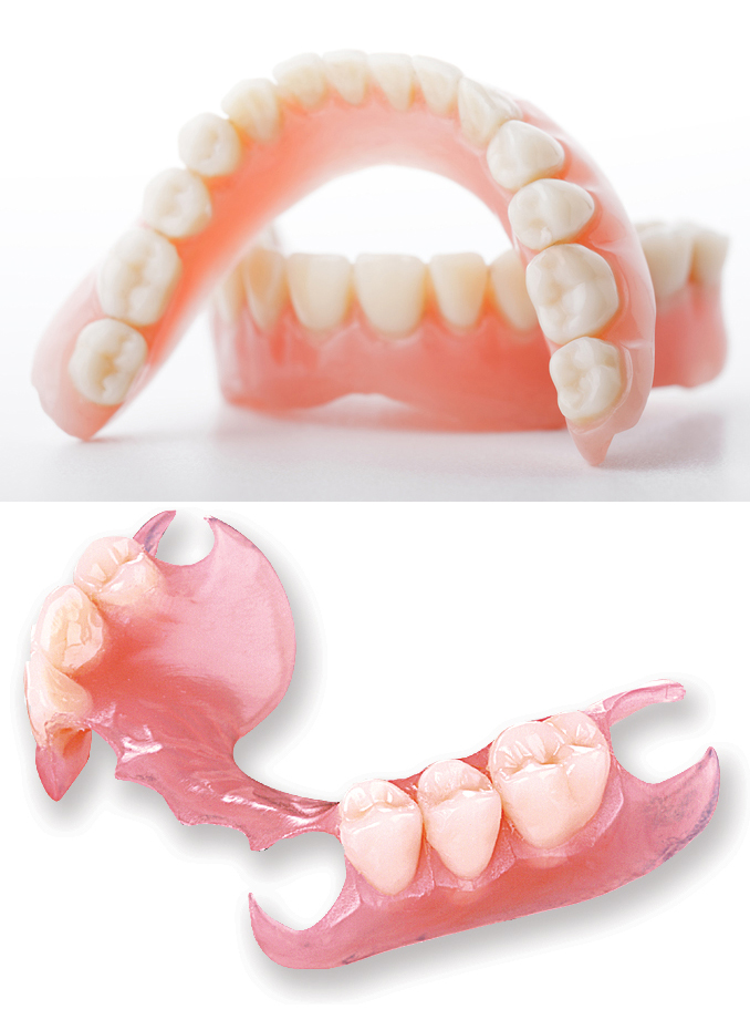 Full/Partial Dentures